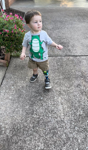 Young boy with prosthetic leg.
